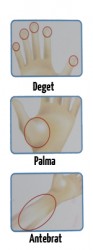 deget-palma-antebrat